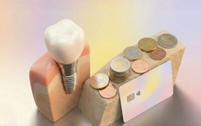 Financiar implantes dentales a plazos